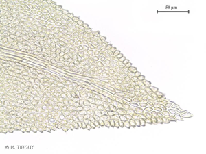 <i>Thuidium tamariscinum</i> (Hedw.) Schimp., 1852 © H. TINGUY
